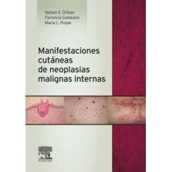 MANIFESTACIONES CUTANEAS DE NEOPLASIAS MALIGNAS INTERNAS