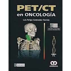 PET/CT EN ONCOLOGIA